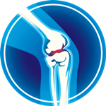 Knee joint replacement in nashik